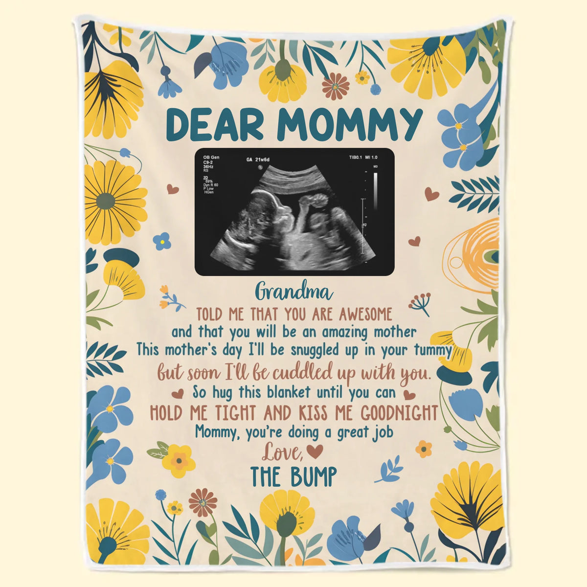 Couverture personnalisée avec photo « Petites mains, grands rêves » pour toute la famille - Cadeau de naissance, cadeau pour la première maman
